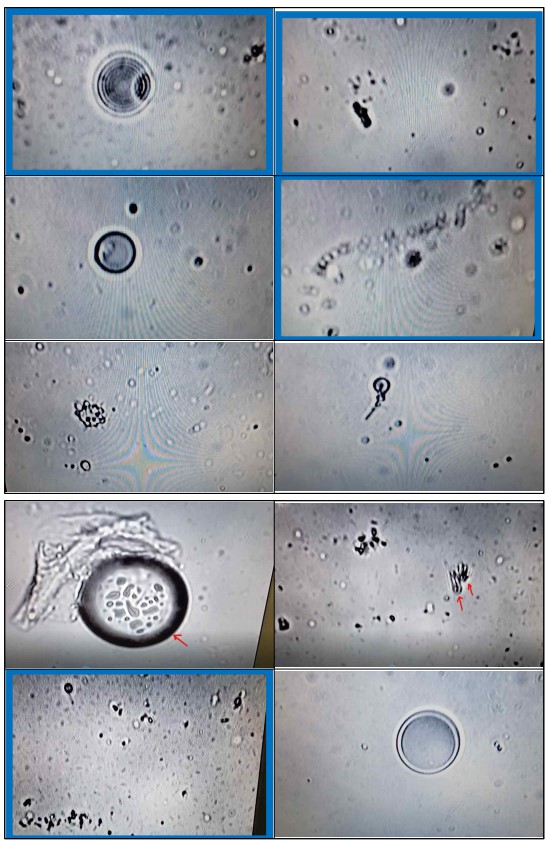 화이자 잔여백신 현미경 관찰